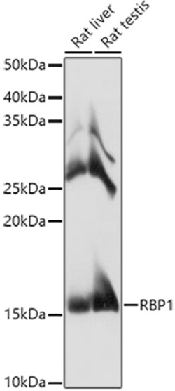 Invitrogen RBP1 Polyclonal Antibody 100 &mu;L; Unconjugated:Antibodies,