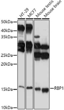 Invitrogen RBP1 Polyclonal Antibody 100 &mu;L; Unconjugated:Antibodies,