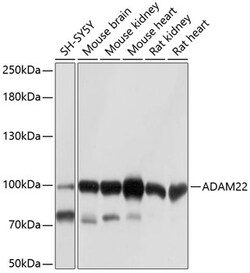Invitrogen ADAM22 Polyclonal Antibody 100 &mu;L; Unconjugated:Antibodies,