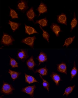 Invitrogen SUCLA2 Polyclonal Antibody 100 &mu;L; Unconjugated:Antibodies,