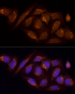 Invitrogen SUCLA2 Polyclonal Antibody 100 &mu;L; Unconjugated:Antibodies,