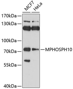 Invitrogen MPP10 Polyclonal Antibody 100 &mu;L; Unconjugated:Antibodies,