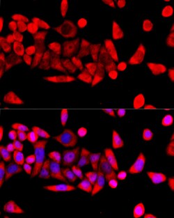 Invitrogen RPL8 Polyclonal Antibody 100 μL; Unconjugated:Antibodies,
