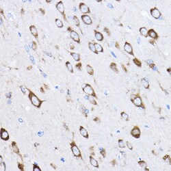 Invitrogen RPL8 Polyclonal Antibody 100 μL; Unconjugated:Antibodies,