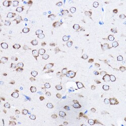 Invitrogen RPL8 Polyclonal Antibody 100 μL; Unconjugated:Antibodies,