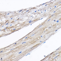 Invitrogen RPL8 Polyclonal Antibody 100 μL; Unconjugated:Antibodies,