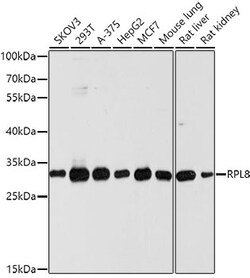 Invitrogen RPL8 Polyclonal Antibody 100 μL; Unconjugated:Antibodies,