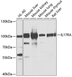 Invitrogen IL-17Ra Polyclonal Antibody 100 &mu;L; Unconjugated:Antibodies,