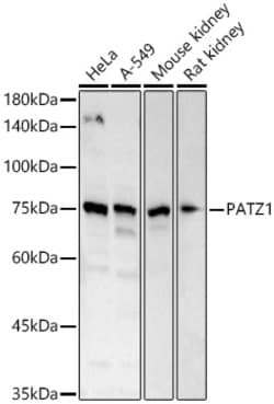Invitrogen PATZ1 Polyclonal Antibody 100 &mu;L; Unconjugated:Antibodies,