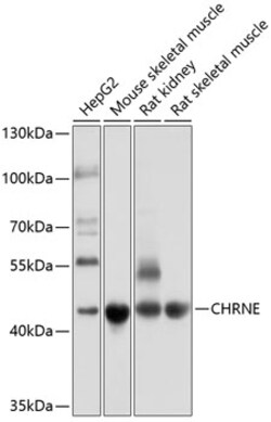 Invitrogen CHRNE Polyclonal Antibody 100 &mu;L; Unconjugated:Antibodies,