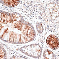 Invitrogen KIR3DL3 Polyclonal Antibody 100 &mu;L; Unconjugated:Antibodies,