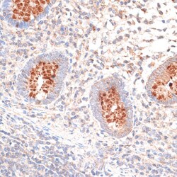 Invitrogen KIR3DL3 Polyclonal Antibody 100 &mu;L; Unconjugated:Antibodies,