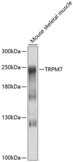 Invitrogen TRPM7 Polyclonal Antibody 100 &mu;L; Unconjugated:Antibodies,