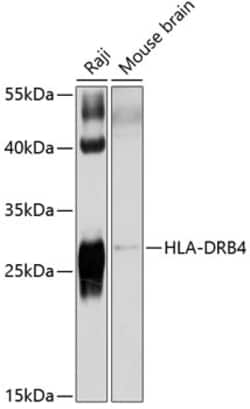 Invitrogen HLA-DRB4 Polyclonal Antibody 100 &mu;L; Unconjugated:Antibodies,