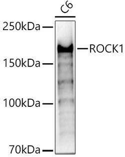 Invitrogen ROCK1 Polyclonal Antibody 100 &mu;L; Unconjugated:Antibodies,