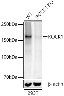 Invitrogen ROCK1 Polyclonal Antibody 100 &mu;L; Unconjugated:Antibodies,