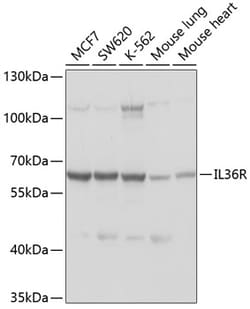 Invitrogen IL1RL2 Polyclonal Antibody 100 &mu;L; Unconjugated:Antibodies,
