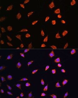 Invitrogen ART1 Polyclonal Antibody 100 &mu;L; Unconjugated:Antibodies,