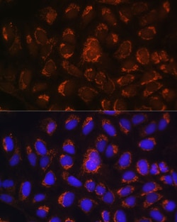 Invitrogen ART1 Polyclonal Antibody 100 &mu;L; Unconjugated:Antibodies,