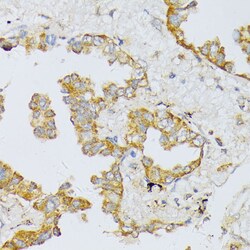 Invitrogen ART1 Polyclonal Antibody 100 &mu;L; Unconjugated:Antibodies,