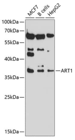 Invitrogen ART1 Polyclonal Antibody 100 &mu;L; Unconjugated:Antibodies,