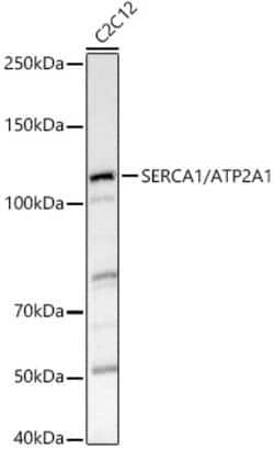 Invitrogen SERCA1 ATPase Polyclonal Antibody 100 &mu;L; Unconjugated:Antibodies,