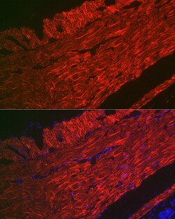 Invitrogen Alpha-Smooth Muscle Actin Polyclonal Antibody 100 &mu;L; Unconjugated:Antibodies,
