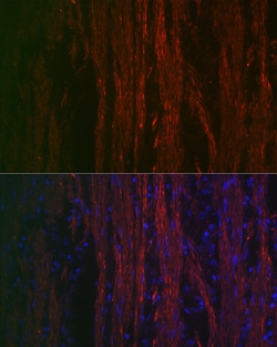 Invitrogen Alpha-Smooth Muscle Actin Polyclonal Antibody 100 &mu;L; Unconjugated:Antibodies,
