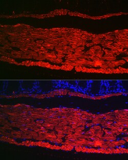 Invitrogen Alpha-Smooth Muscle Actin Polyclonal Antibody 100 &mu;L; Unconjugated:Antibodies,