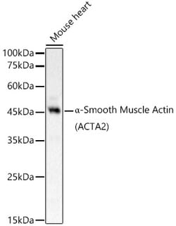 Invitrogen Alpha-Smooth Muscle Actin Polyclonal Antibody 100 &mu;L; Unconjugated:Antibodies,