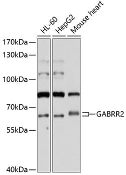 Invitrogen GABRR2 Polyclonal Antibody 100 &mu;L; Unconjugated:Antibodies,