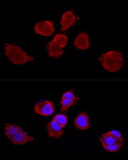 Invitrogen Cytokeratin 3 Polyclonal Antibody 100 &mu;L; Unconjugated:Antibodies,