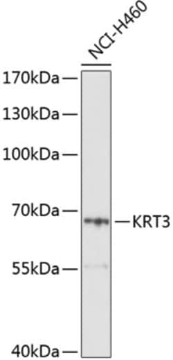 Invitrogen Cytokeratin 3 Polyclonal Antibody 100 &mu;L; Unconjugated:Antibodies,