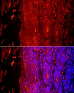 Invitrogen KRT9 Polyclonal Antibody 100 &mu;L; Unconjugated:Antibodies,