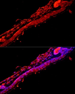 Invitrogen KRT9 Polyclonal Antibody 100 &mu;L; Unconjugated:Antibodies,