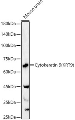 Invitrogen KRT9 Polyclonal Antibody 100 &mu;L; Unconjugated:Antibodies,
