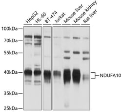 Invitrogen NDUFA10 Polyclonal Antibody 100 &mu;L; Unconjugated:Antibodies,