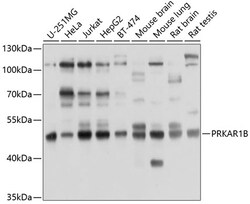Invitrogen PRKAR1B Polyclonal Antibody 100 &mu;L; Unconjugated:Antibodies,