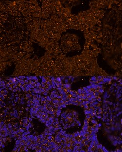 ZP2 Polyclonal Antibody, Invitrogen 100 &mu;L; Unconjugated:Antibodies,