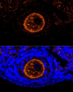 ZP2 Polyclonal Antibody, Invitrogen 100 &mu;L; Unconjugated:Antibodies,