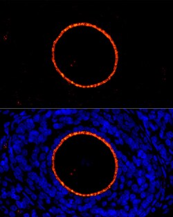 ZP2 Polyclonal Antibody, Invitrogen 100 &mu;L; Unconjugated:Antibodies,
