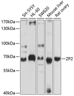 ZP2 Polyclonal Antibody, Invitrogen 100 &mu;L; Unconjugated:Antibodies,