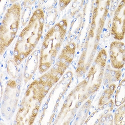 Invitrogen IKAP Polyclonal Antibody 100 &mu;L; Unconjugated:Antibodies,