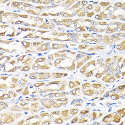 Invitrogen IKAP Polyclonal Antibody 100 &mu;L; Unconjugated:Antibodies,