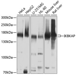 Invitrogen IKAP Polyclonal Antibody 100 &mu;L; Unconjugated:Antibodies,