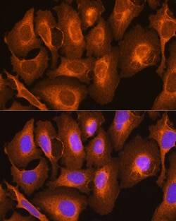 Invitrogen HLA-C Polyclonal Antibody 100 &mu;L; Unconjugated:Antibodies,