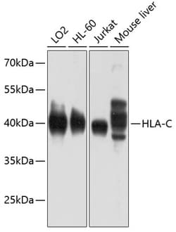 Invitrogen HLA-C Polyclonal Antibody 100 &mu;L; Unconjugated:Antibodies,