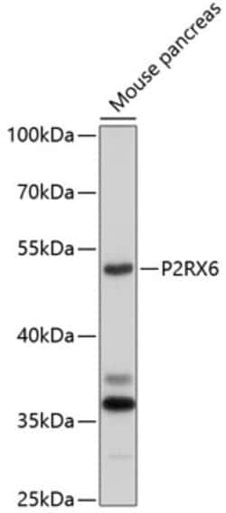 Invitrogen P2X6 Polyclonal Antibody 100 &mu;L; Unconjugated:Antibodies,