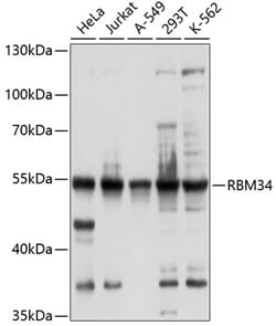 Invitrogen RBM34 Polyclonal Antibody 100 &mu;L | Buy Online | Invitrogen&trade; | Fisher Scientific