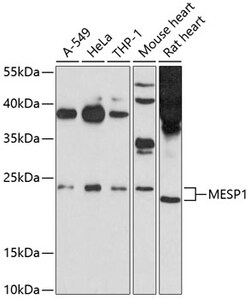 MESP1 Polyclonal Antibody, Invitrogen 100 &mu;L; Unconjugated:Antibodies,